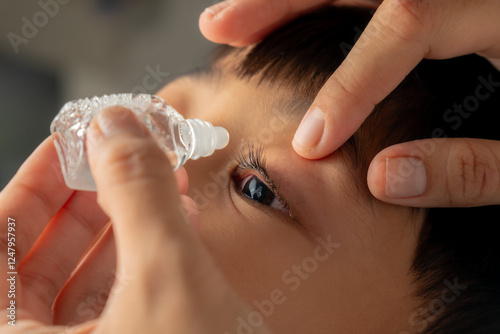 A mother putting eye drops in her child's eyes to relieve irritation