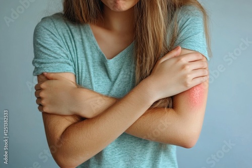 Sensitive skin allergic concept, Woman itching on her arm have a red rash from allergy symptom and from scratching