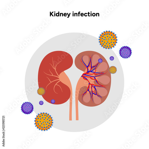 Kidney infection urology urinary problem. Medical diagram 