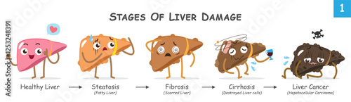 Stages of liver damage . Collection of cute medical cartoon characters about progression of liver disease . Vector .