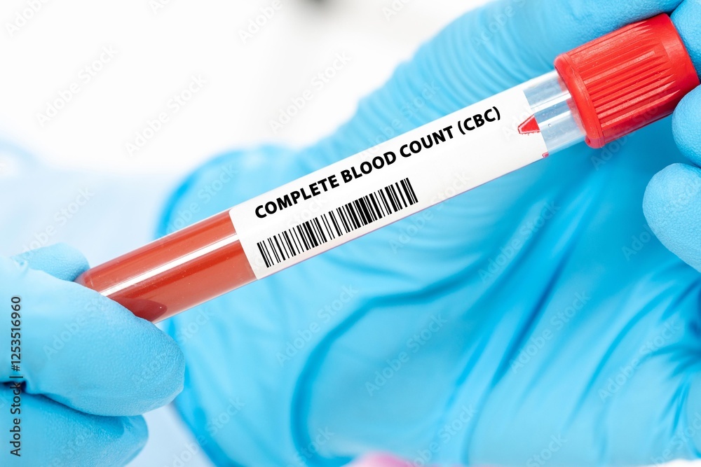 Naklejka premium Complete Blood Count (CBC)