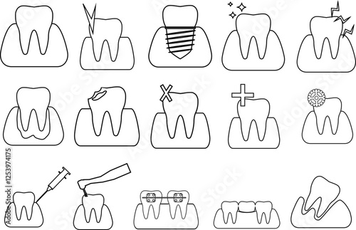This is a collection of black and white teeth icons representing various dental diseases and treatments. Icons represent healthy teeth, tooth decay, tooth decay, braces, extractions, fillings, implan