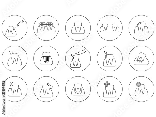 This is a collection of black and white teeth icons representing various dental diseases and treatments. Icons represent healthy teeth, tooth decay, tooth decay, braces, extractions, fillings, implan