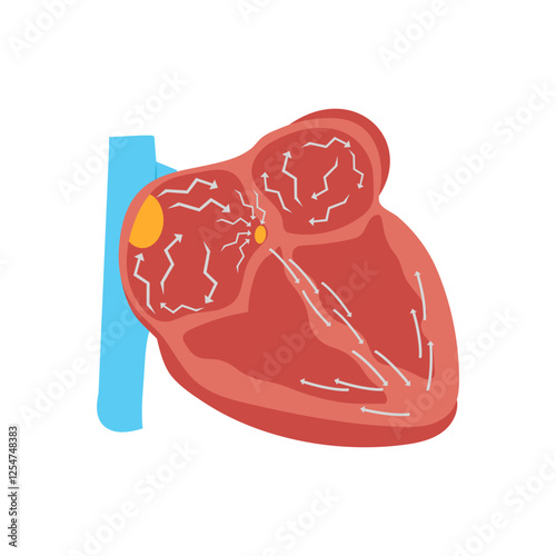 Atrial Fibrillation, Cardiovascular Disease Illustration Icon