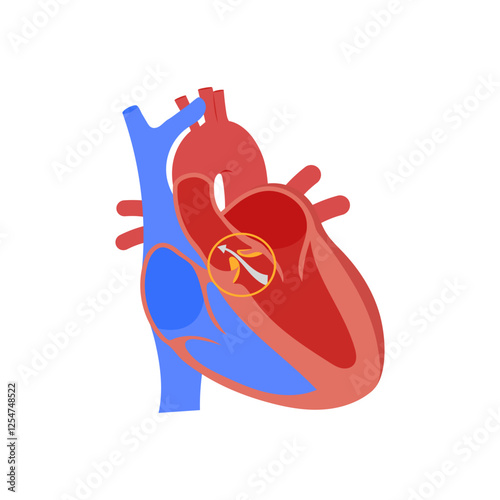 Hypotension, Cardiovascular Disease Illustration Icon