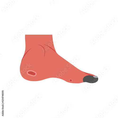 Ischemia, Cardiovascular Disease Illustration Icon