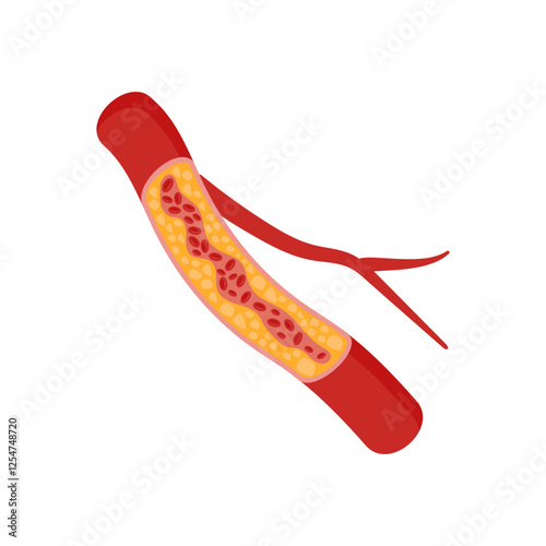 Low Density Lipoprotein, Cardiovascular Disease Illustration Icon