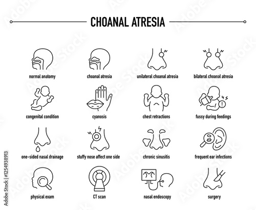 Choanal Atresia symptoms, diagnostic and treatment vector icon set. Line editable medical icons.