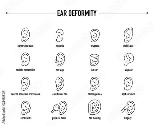 Ear Deformity symptoms, diagnostic and treatment vector icon set. Line editable medical icons.