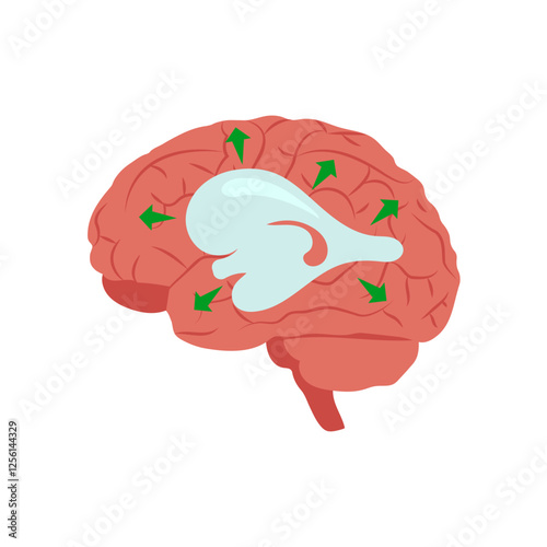 Hydrocephalus, Disability Vector Illustration Isolated