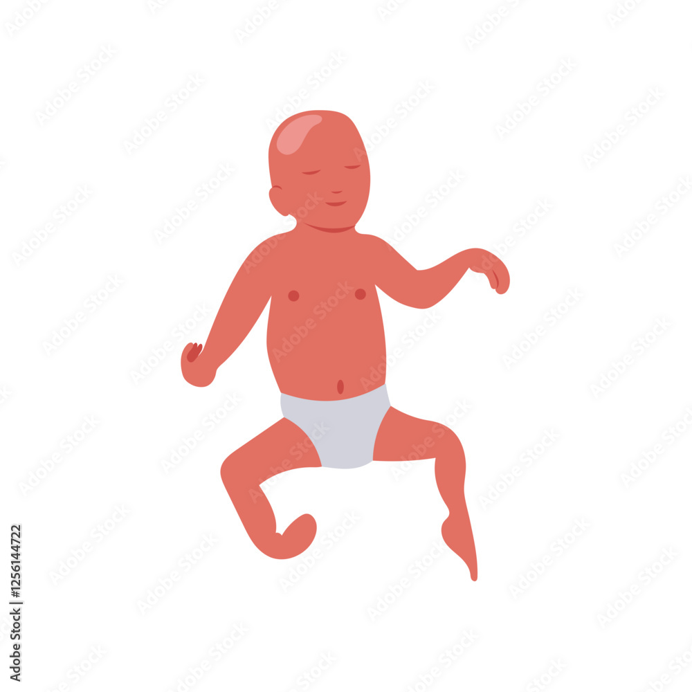 Arthrogryposis, Disability Vector Illustration Isolated Arthrogryposis, Disability Vector Illustration Isolated