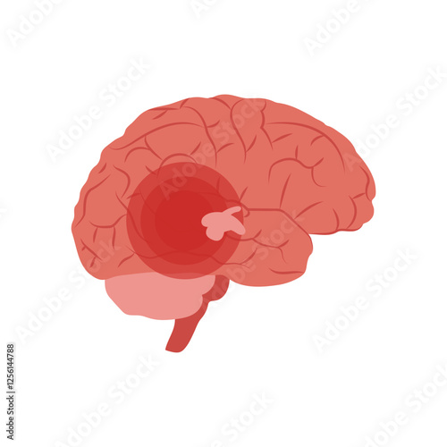 Epilepsy, Disability Vector Illustration Isolated