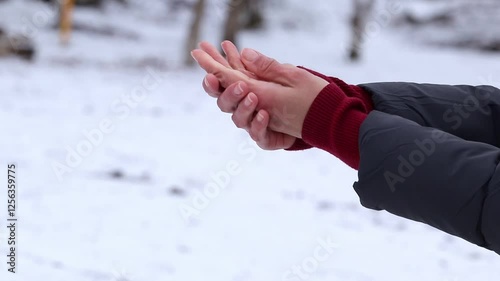 Girl's hands in the cold.Women's hands with dry damaged skin in winter.Hand skin care concept in cold season.
