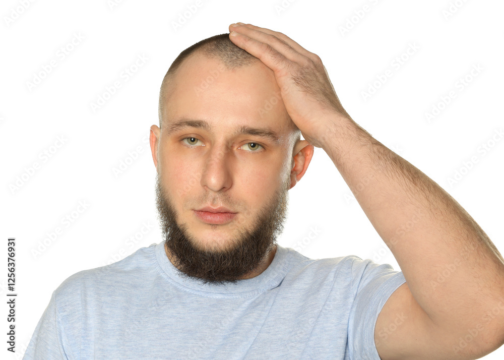 Baldness problem. Man with receding hairline on white background Baldness problem. Man with receding hairline on white background