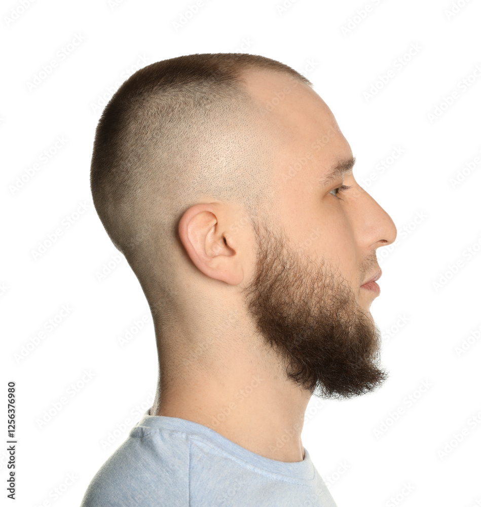 Baldness problem. Man with receding hairline on white background Baldness problem. Man with receding hairline on white background