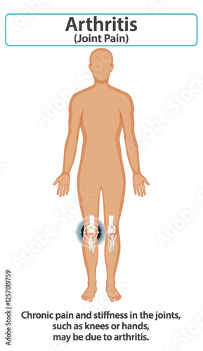 Understanding Arthritis and Joint Pain