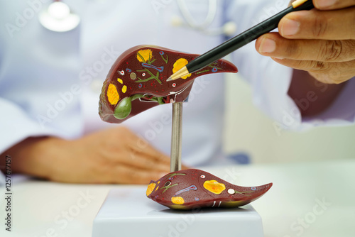 Принти на полотні Cirrhosis, Liver cancer, fatty liver, Asian doctor with liver human anatomy model in World Hepatitis Day at hospital