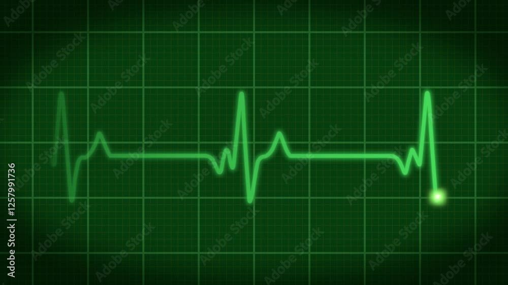 Heart Rate Monitor Green Overlay Vital Signs Pulse Medical 4K Res Heart Rate Monitor Green Overlay Vital Signs Pulse Medical 4K Res