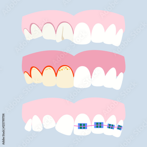 Various dental problems and diseases. Oral problems, caries, tartar, plaque, orthodontic braces, various injuries. Vector illustration