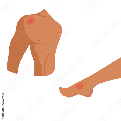 Pain in shoulder, leg. Vector illustration