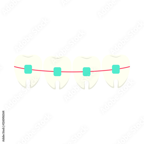 Braces Teeth Dental Illustration