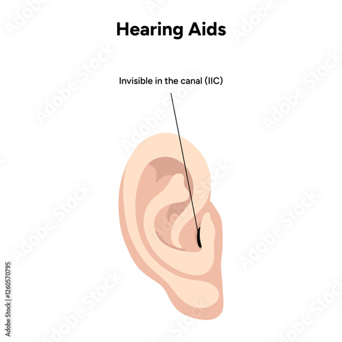 Hearing aids in-the-ear ITE. Invisible in the canal IIC. Microphone technology listening for deaf people