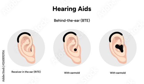 Hearing aids behind-the-ear (BTE). Receiver in the ear (RITE), and with earmold. Microphone technology listening for loss hearing people