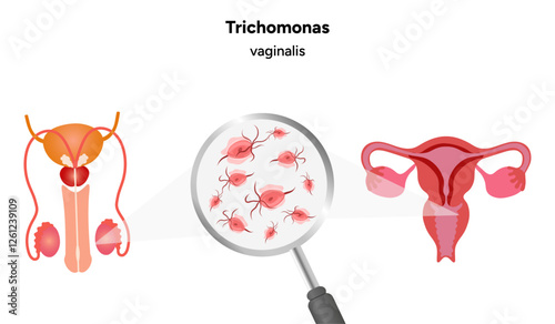 Trichomonas Vaginalis parasites zoom. Men and women infection disease 