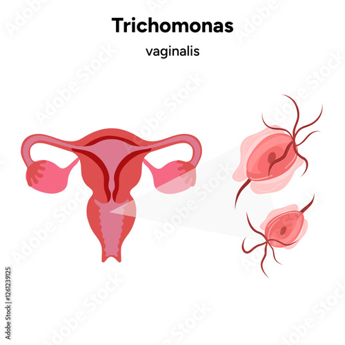 Trichomonas Vaginalis parasites zoom. Men and women infection disease 