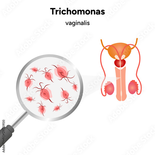 Trichomonas Vaginalis parasites zoom. Men and women infection disease 