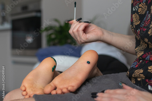 Woman treating her son's plantar warts while he lying on the couch