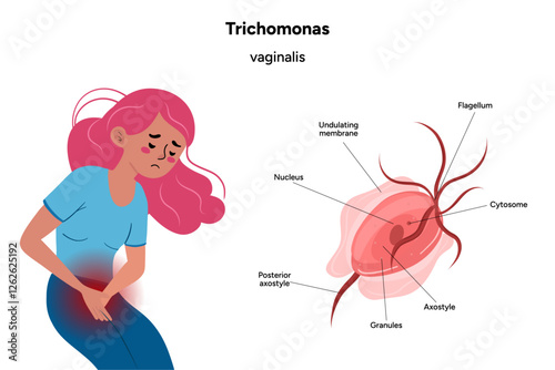 Trichomonas Vaginalis parasites zoom. Men and women infection disease. Woman feels discomfort 