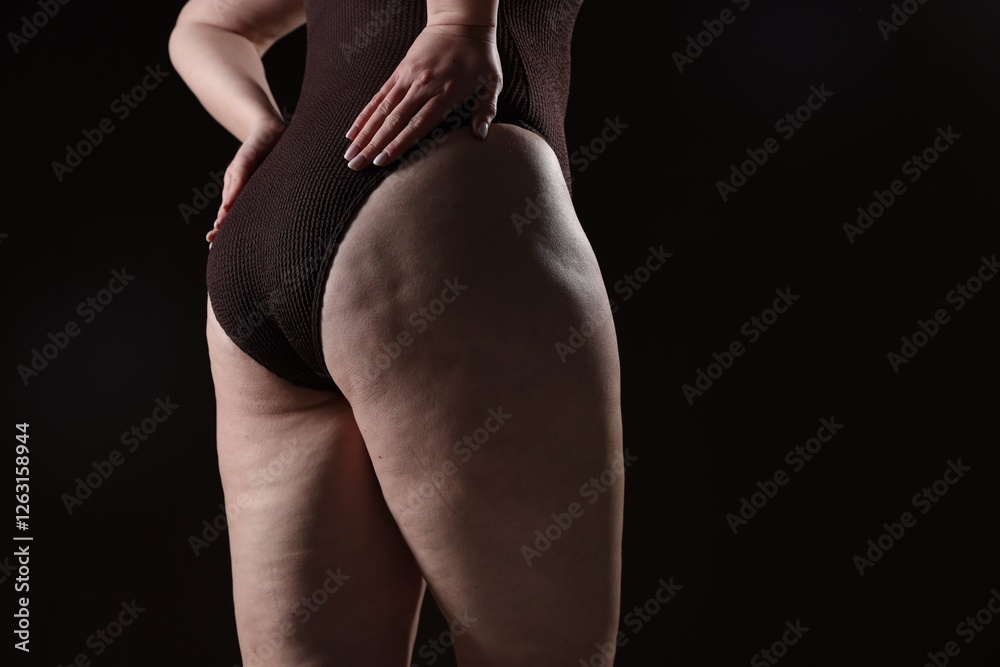Naklejka premium Woman with cellulite problem on black background, closeup. Space for text