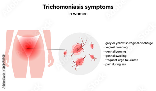 Trichomonas Vaginalis parasites zoom. Men and women infection disease. Trichomonas symptoms in woman
