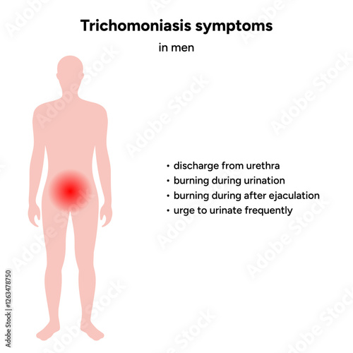 Trichomonas Vaginalis parasites zoom. Men and women infection disease. Trichomonas symptoms in man