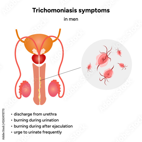Trichomonas Vaginalis parasites zoom. Men and women infection disease. Trichomonas symptoms in man