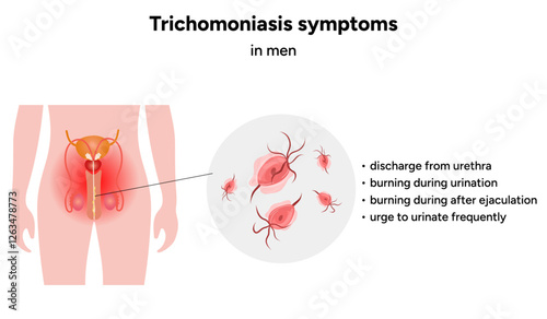 Trichomonas Vaginalis parasites zoom. Men and women infection disease. Trichomonas symptoms in man