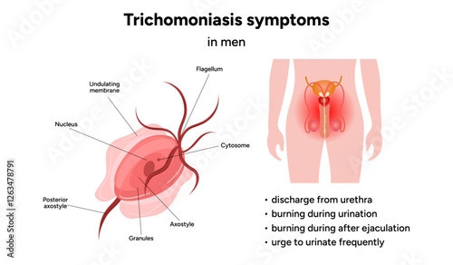 Trichomonas Vaginalis parasites zoom. Men and women infection disease. Trichomonas symptoms in man