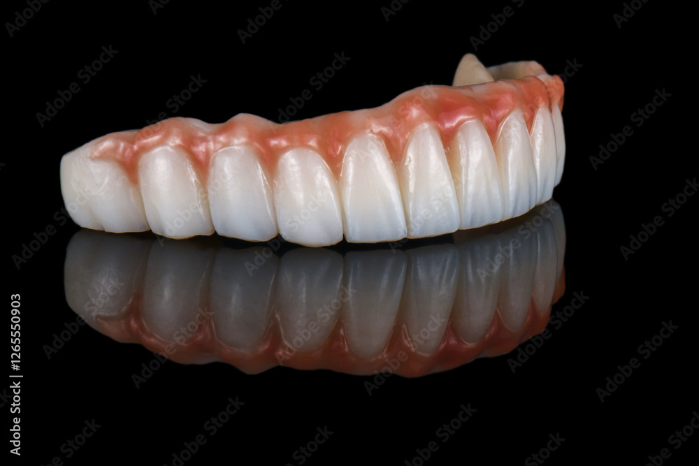 Fototapeta premium zirconium bridge on implants