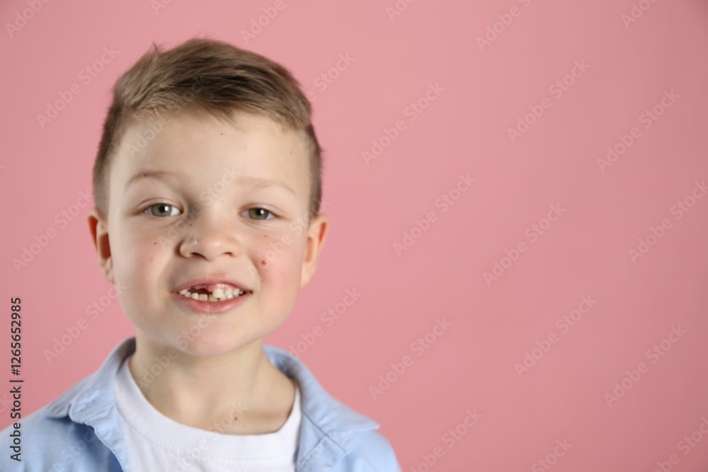 Cute little boy with missing tooth on pink background, space for text Cute little boy with missing tooth on pink background, space for text