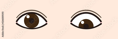 下斜視のイラスト