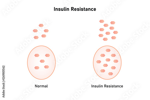 Insulin Resistance Science Design. Vector Illustration.