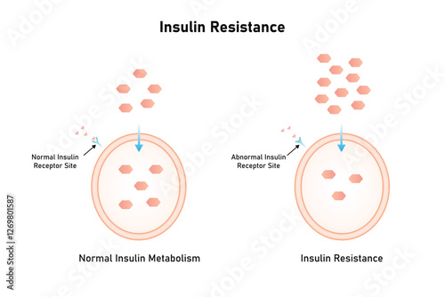 Insulin Resistance Science Design. Vector Illustration.