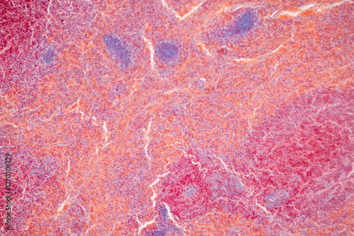 Showing Light micrograph of the Adrenal gland, Spleen human and Other human tissues under the microscope for education in the laboratory.