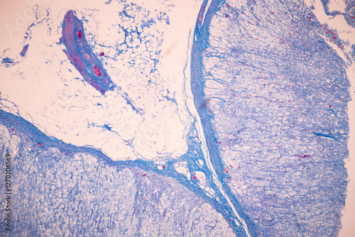 Showing Light micrograph of the Adrenal gland, Spleen human and Other human tissues under the microscope for education in the laboratory.