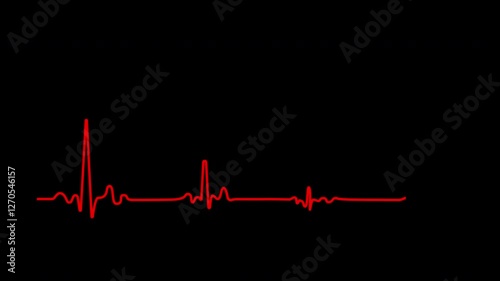 Heart failure, cardiac arrest, wave attenuation chart self drawing animation. red line animated on black background.