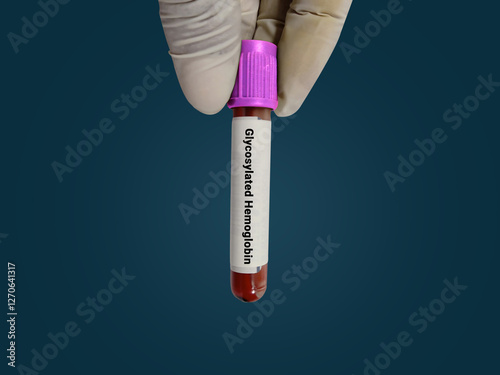 Scientist hold blood sample test tube for  
Glycosylated Hemoglobin test with laboratory background. Healthcare and medical test concept. photo