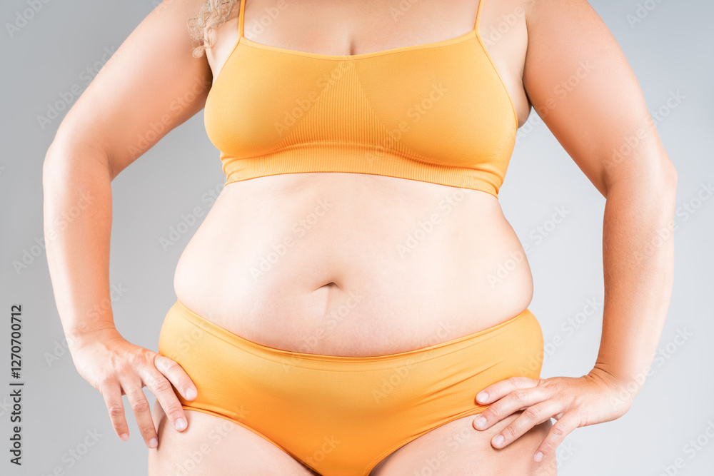Φωτογραφία Tummy tuck, flabby skin on a fat belly, abdomen with obesity and cellulite, sagg