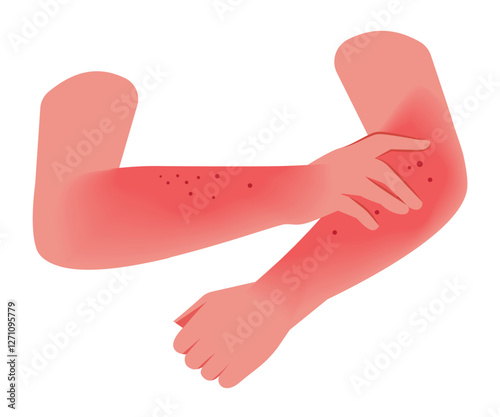 Scratching the itch hands redness rash. Healthy skin care concept stock illustration