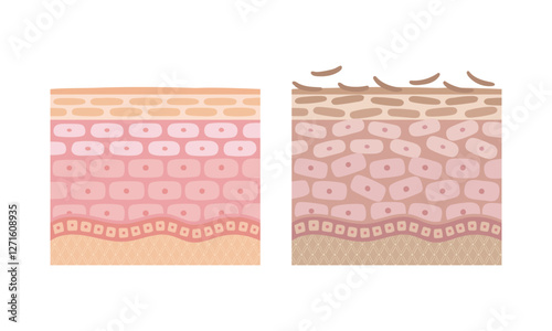 健康な肌と不健康な肌の比較イラスト